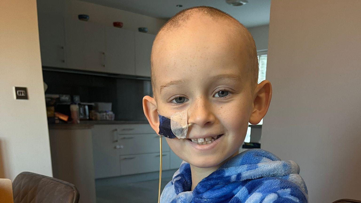 Oliver Stephenson in his kitchen wearing a blue fleecy top and with a tube in his nose 