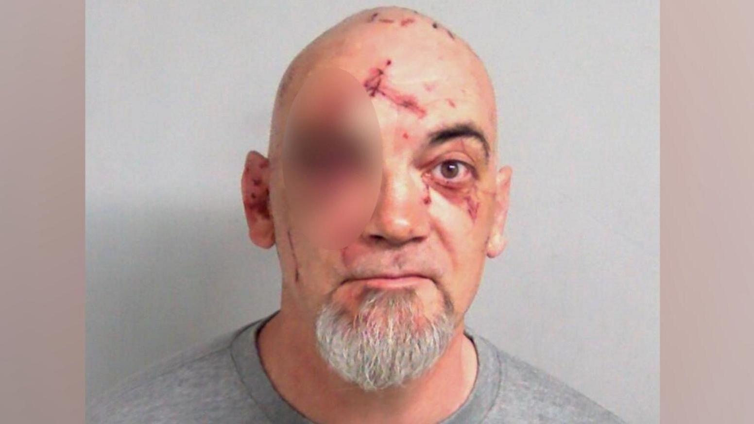 Police custody image of Kevin Horswill, shown in a grey sweater and with several injuries to his face. He is bald and has a grey goatee. His right eye is blurred out due to the extent of his injury.