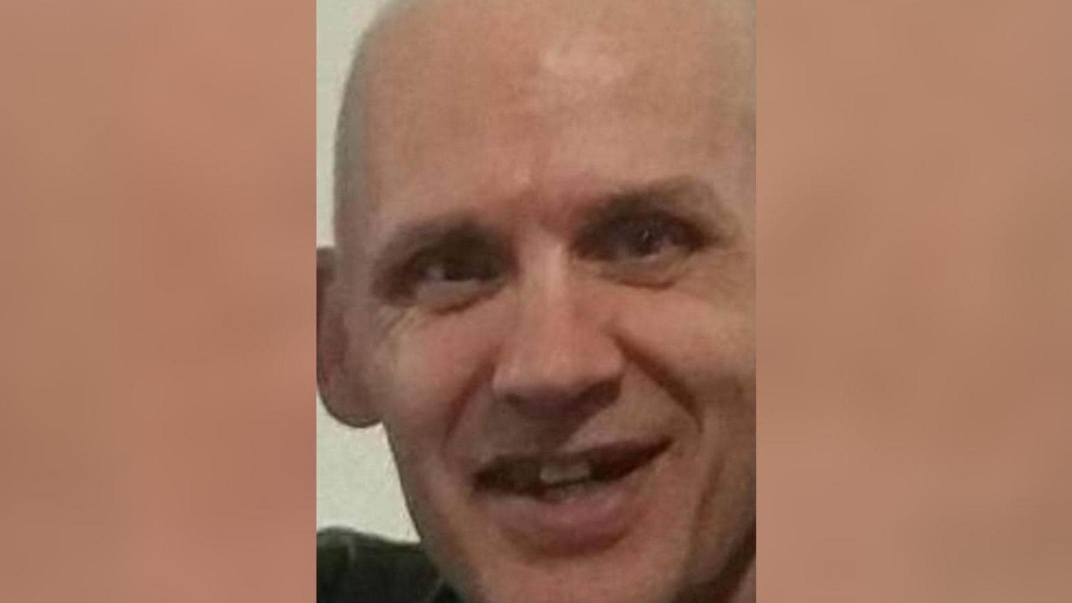 A man smiling with his teeth showing. He has a bald head and is wearing a dark top.