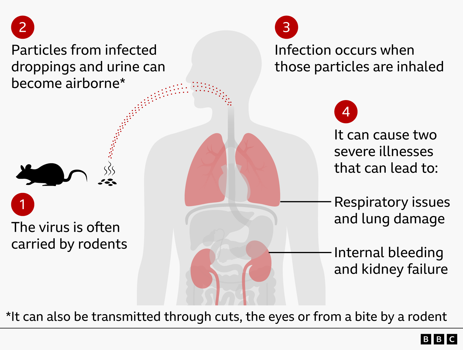 Hantavirus Cases Rise as CDC Sounds Alarm