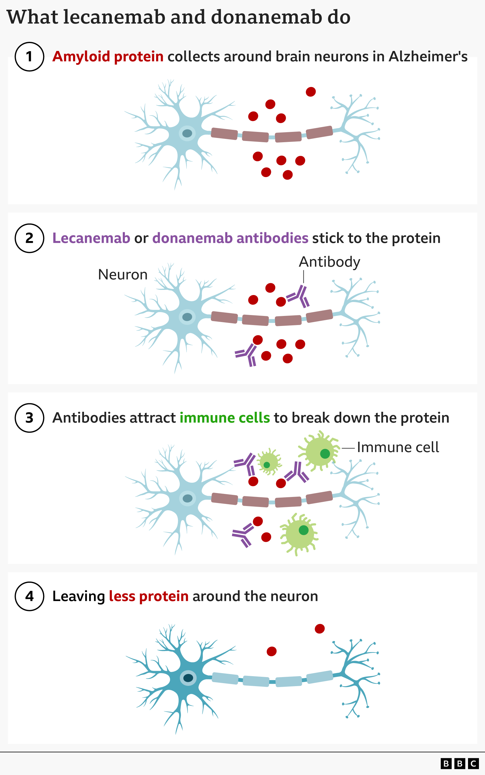 Graphic showing how the lecanemab or donanemab antibodies stick to the protein which builds up around the neuron's in the brain of someone with Alzheimer's. This then helps the bodies immune cells target and remove the protein from the brain.
