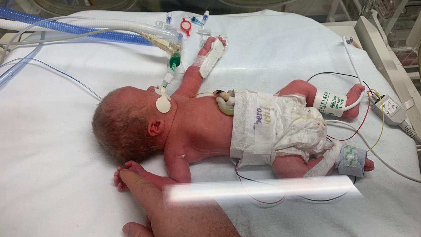 Baby Ralphie lays inside an incubator. His hand is holding his dad's finger. Ralphie is attached to a ventilator and other medical monitoring equipment