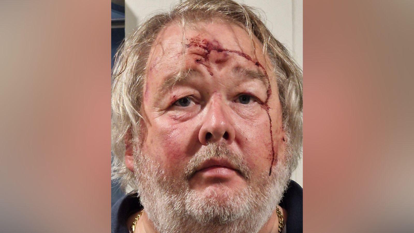 Christopher MIlls ar ol yr ymosodiad