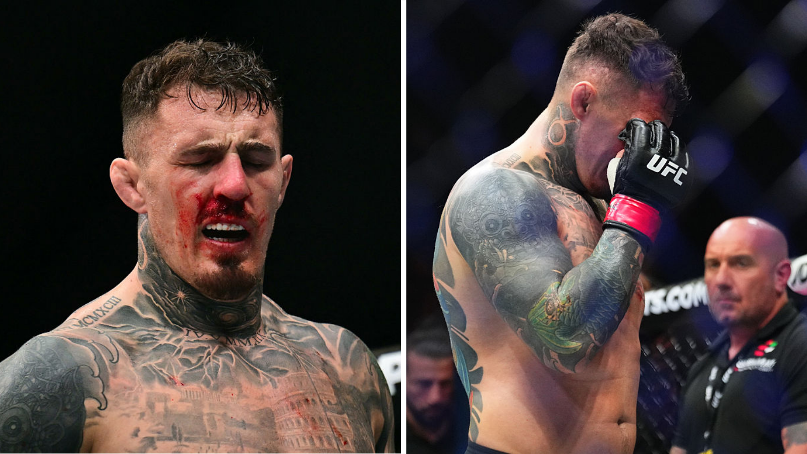 Tom Aspinall suffering from an eye poke