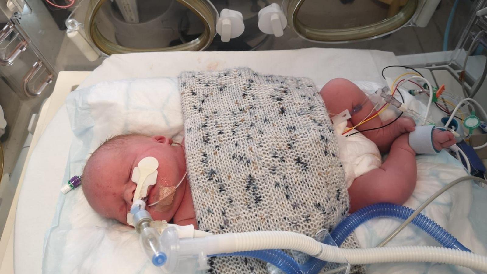 Ari is being monitored while lay inside a hospital incubator as a baby. Breathing tubes are connected to his nose and other wires have been attached to his feet and stomach. His belly has been covered by a small grey knitted blanket.