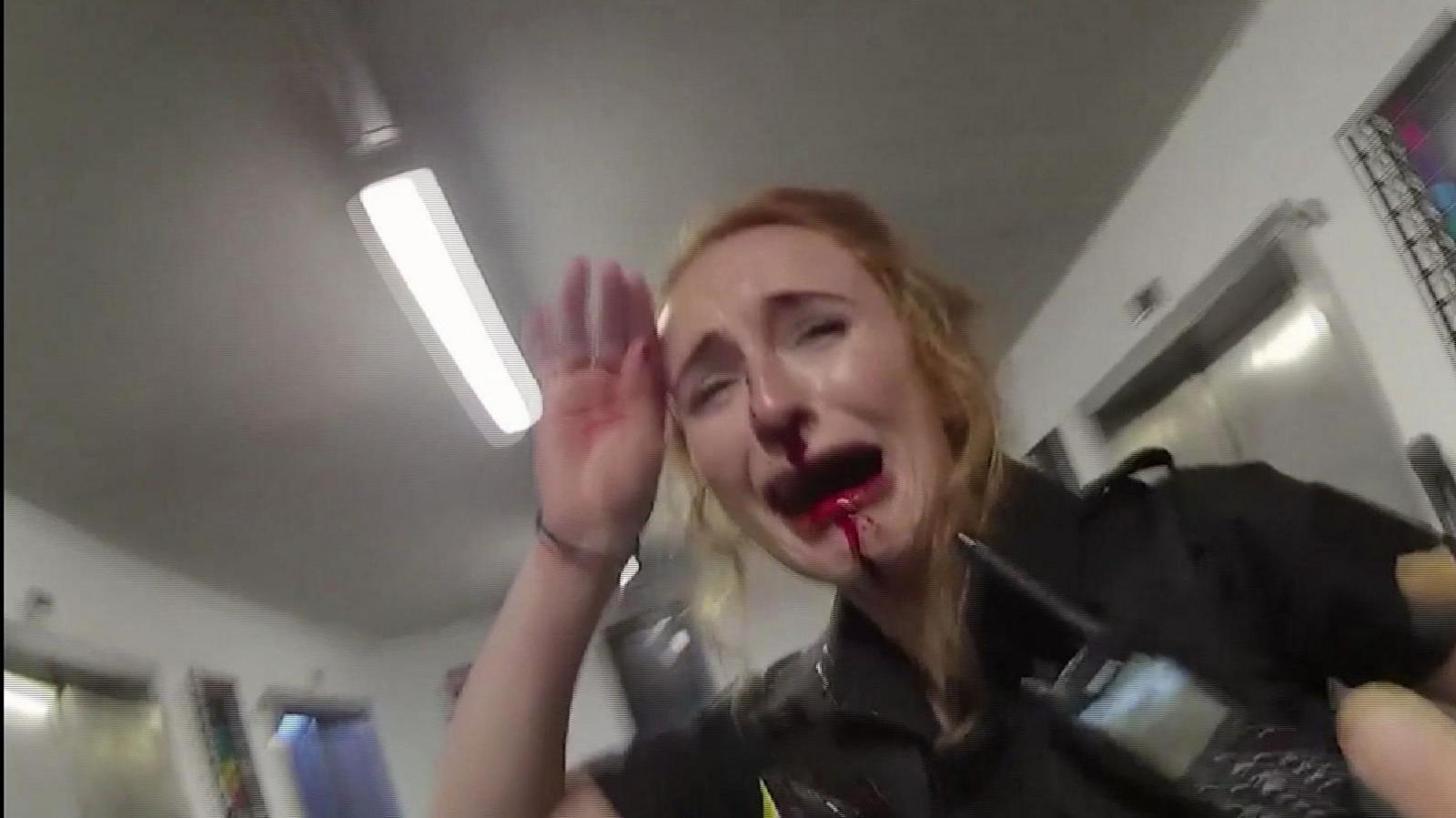 A police officer with a broken and bloody nose is crying and holding a hand to her face