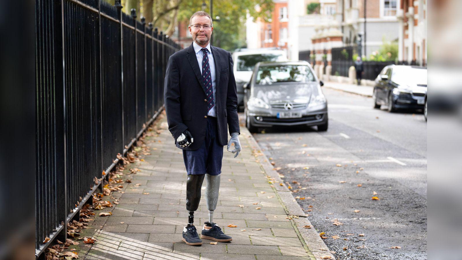 A man with prosthetic hands and legs. He is wearing a suit.