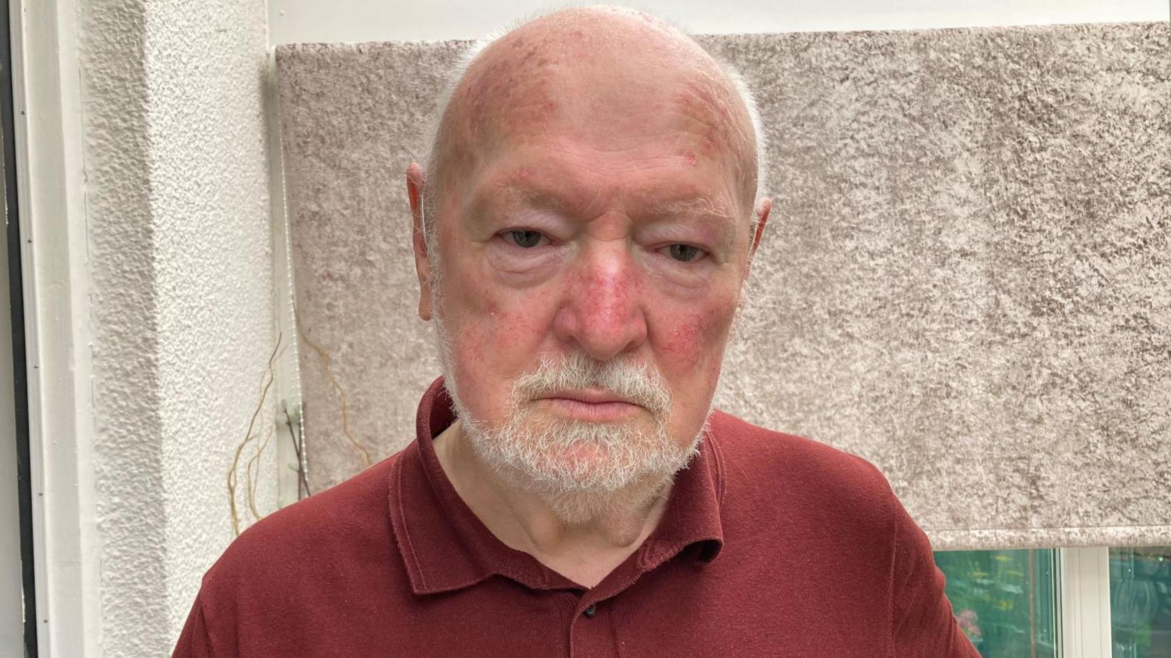 A man with short grey hair looks at the camera with a straight face.