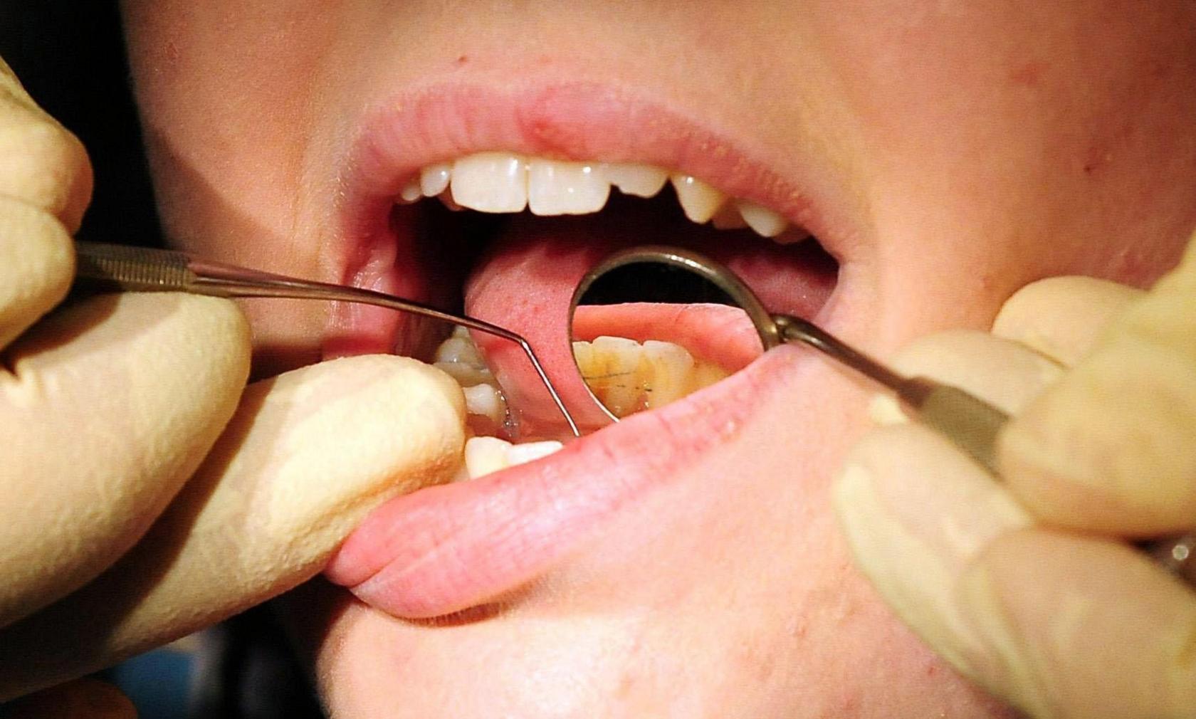 Dental treatment