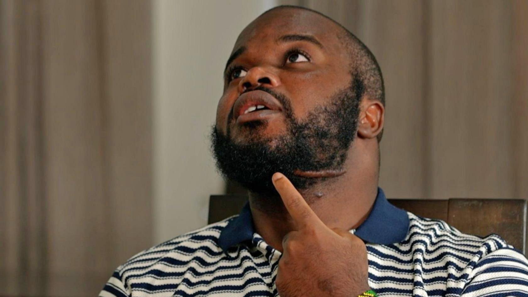 A head shot of Edgar Mwakabela taken from below with a scar around his jaw clearly visible. He is pointing at his jaw.
