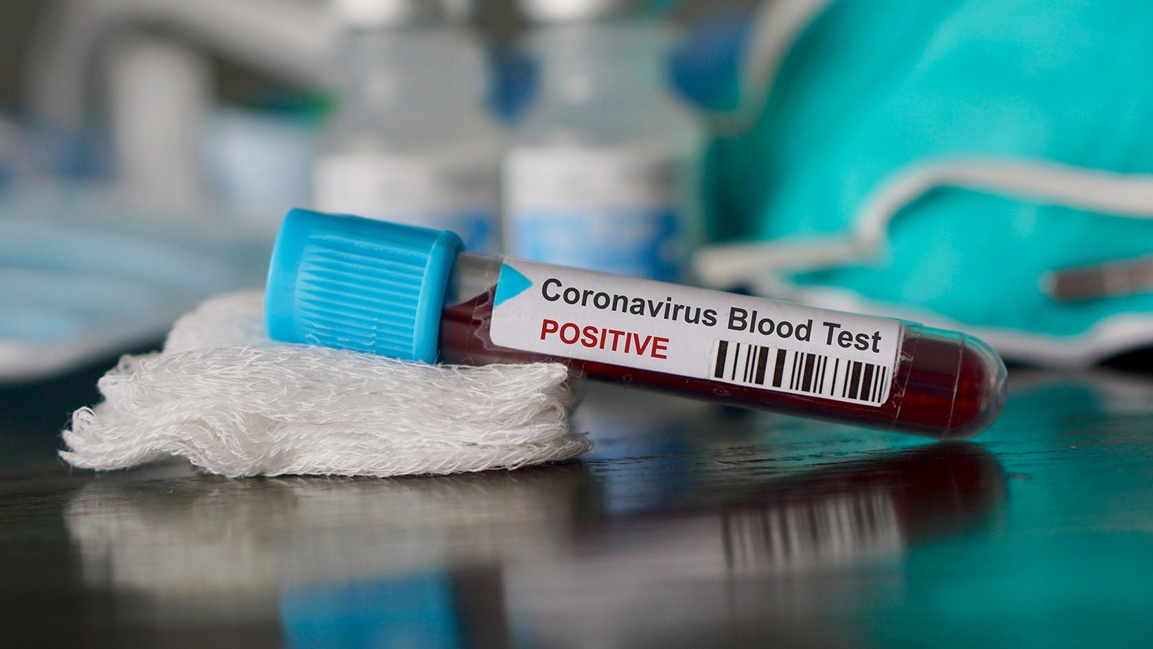 Coronavirus test