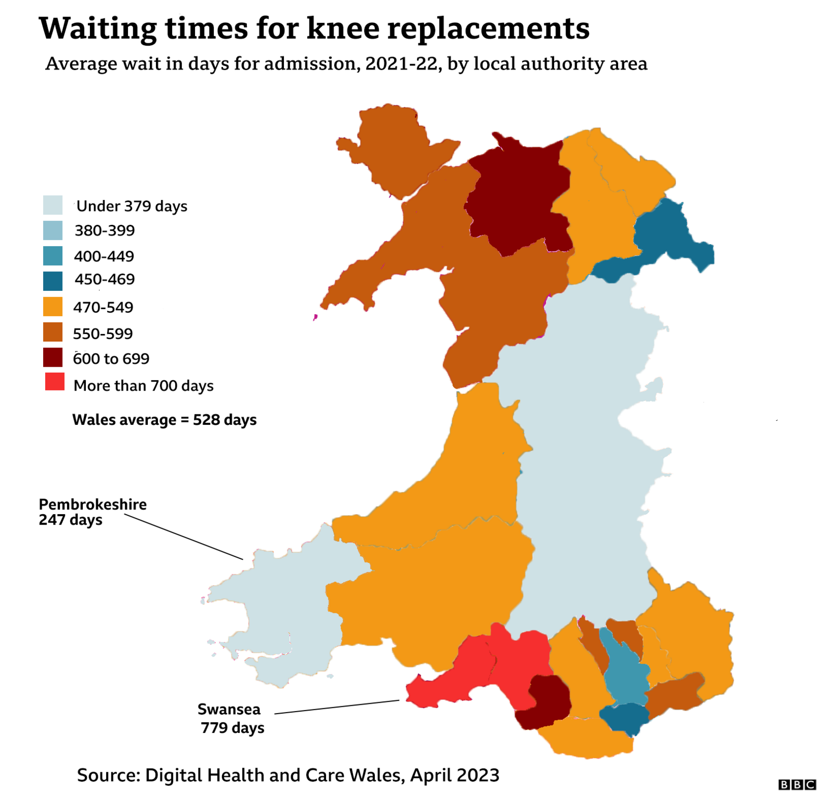 Knee waiting times