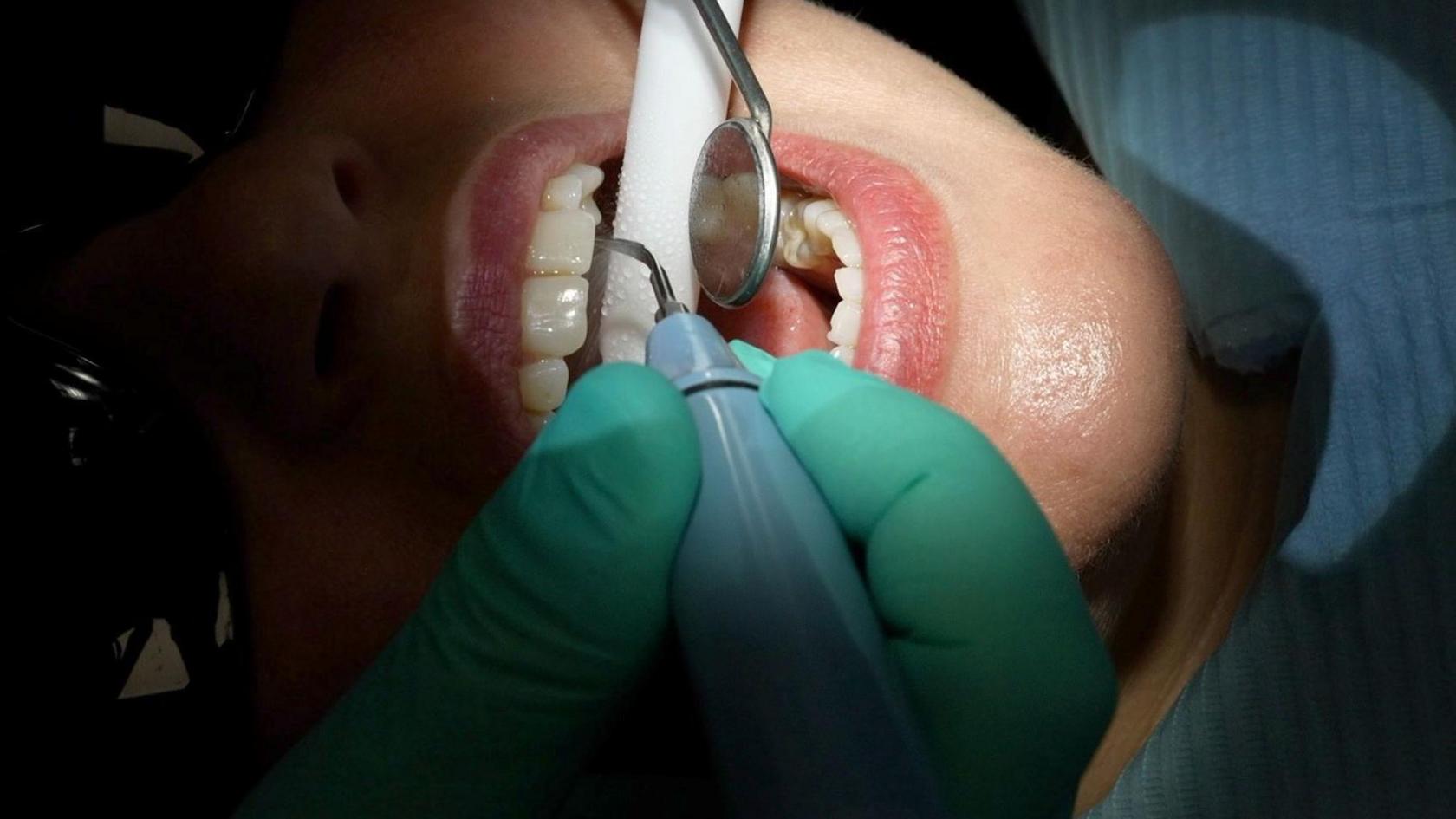 A woman has her teeth examined by an anonymous dentist. The picture shows a hand in a glove holding a dental mirror inside a mouth while a suction device is used as well as a plaque remover. The woman has her mouth open in the chair and her face is lit