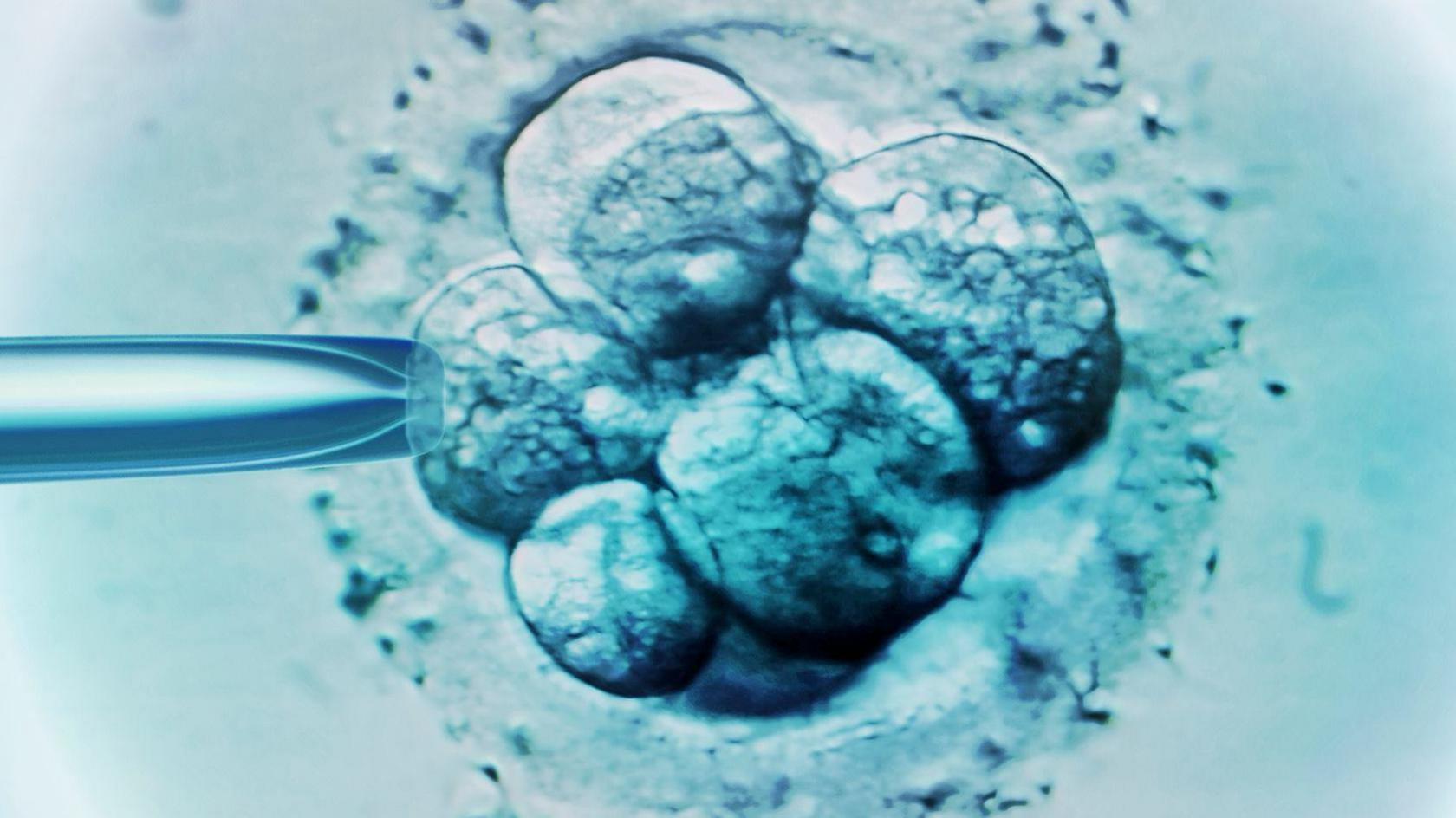 IVF involves removing eggs from ovaries and fertilising with a partner's sperm or a donor's sperm in a laboratory