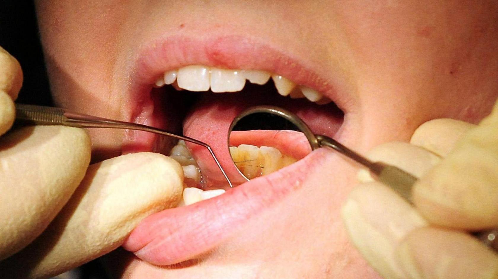 Dentist's hands in rubber gloves holding tools in child's mouth