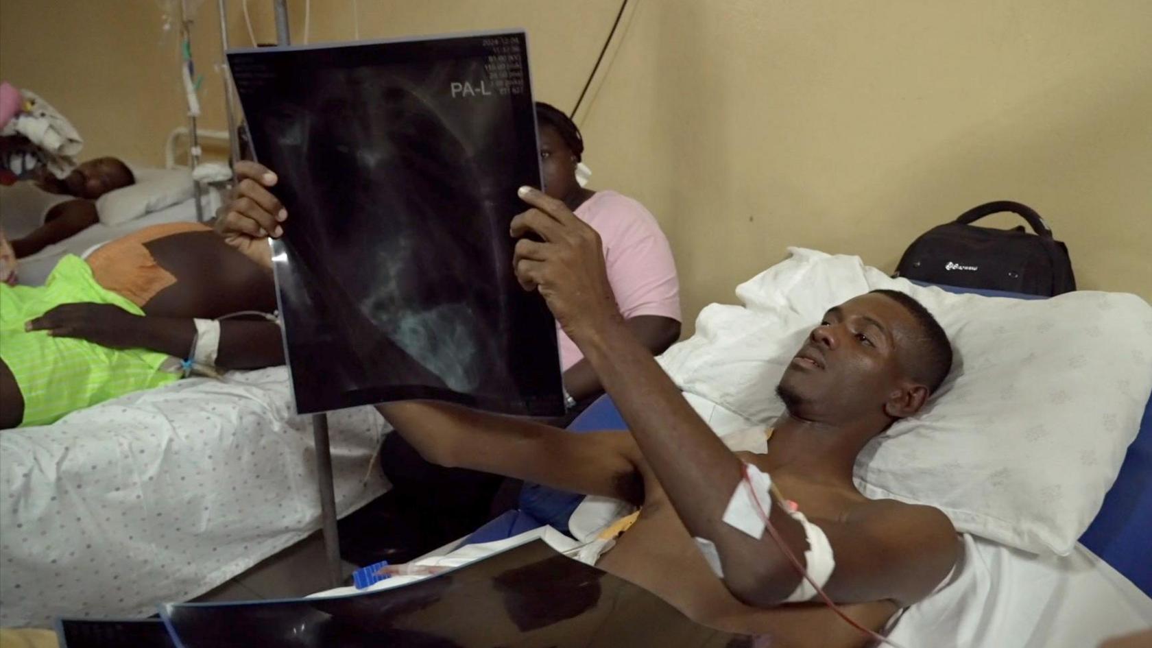 A man lies on a narrow hospital bed looking at an x-ray, other patients are lying in beds next to him. 