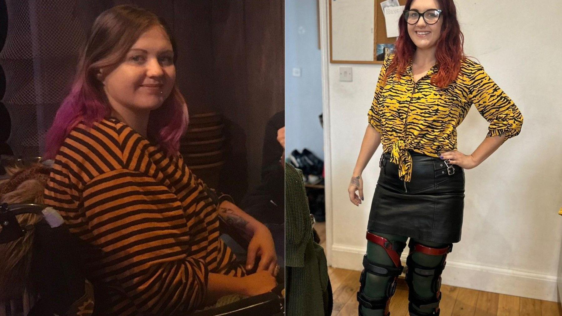 A before and after image showing Santana Corr using her wheelchair and now standing unaided, wearing her leg braces that she has to use with her condition to support her knees.