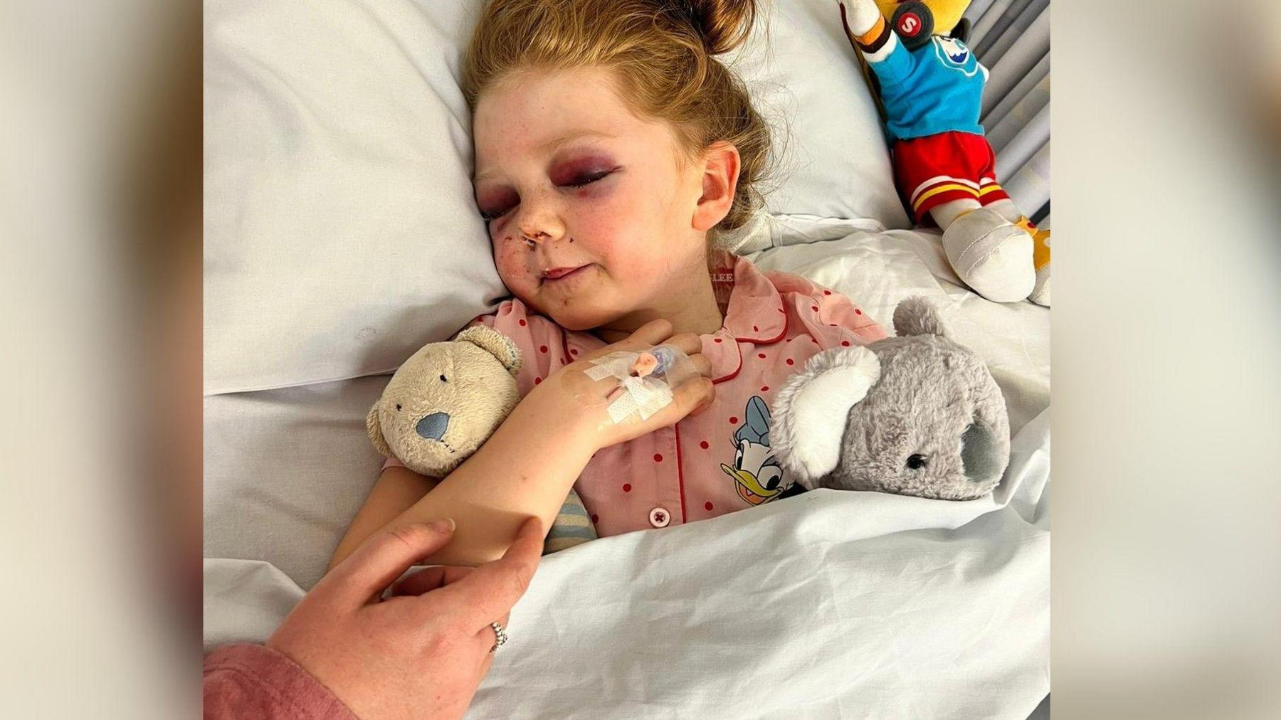 Lily-Mae seen lying in a hospital bed with bruised eyes, clutching cuddly toys.