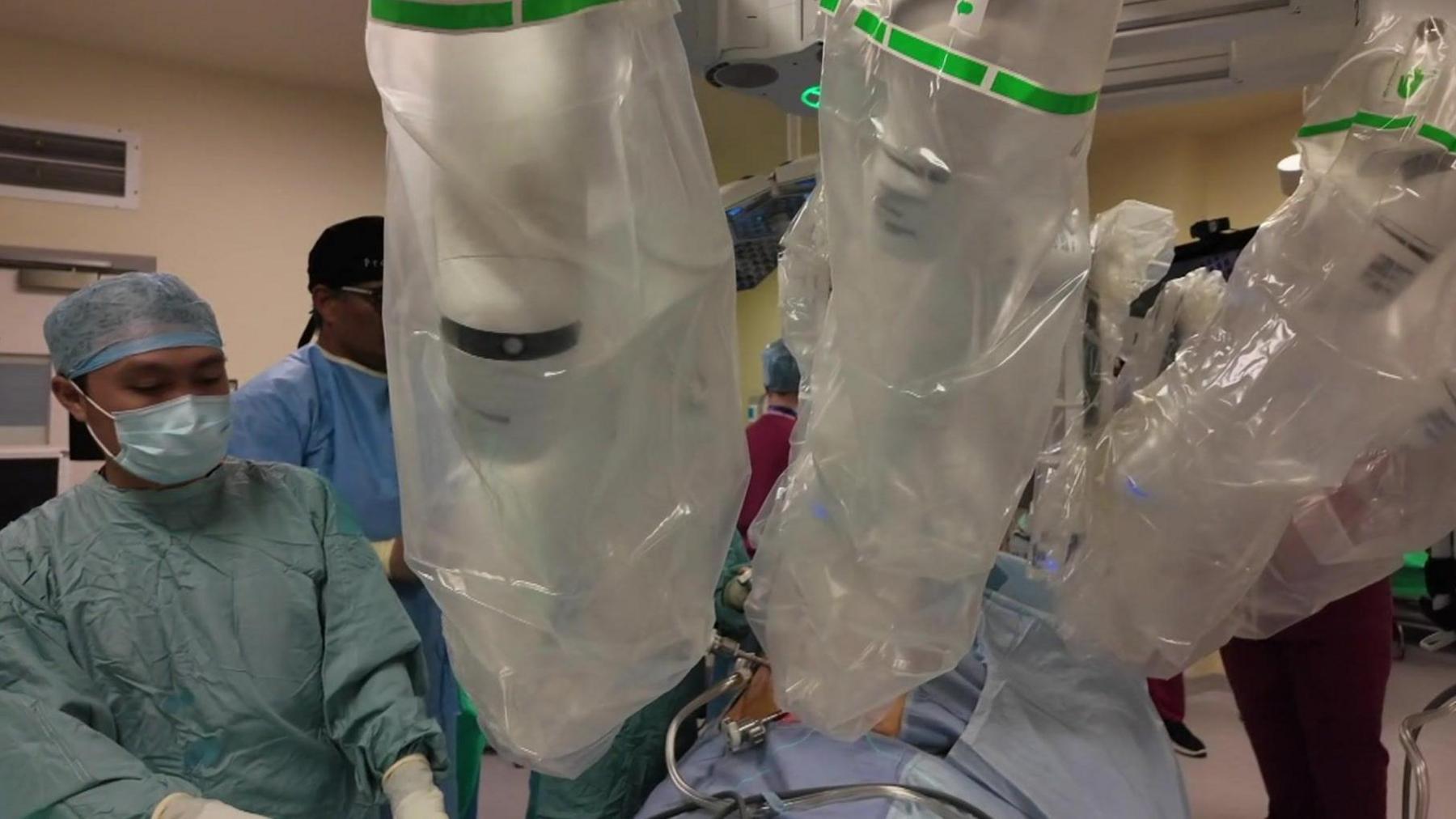 An operation being carried out in an operating theatre. Robotic arms covered in plastic hold the instruments over the patient's body. A surgeon in medical dress is standing beside them.