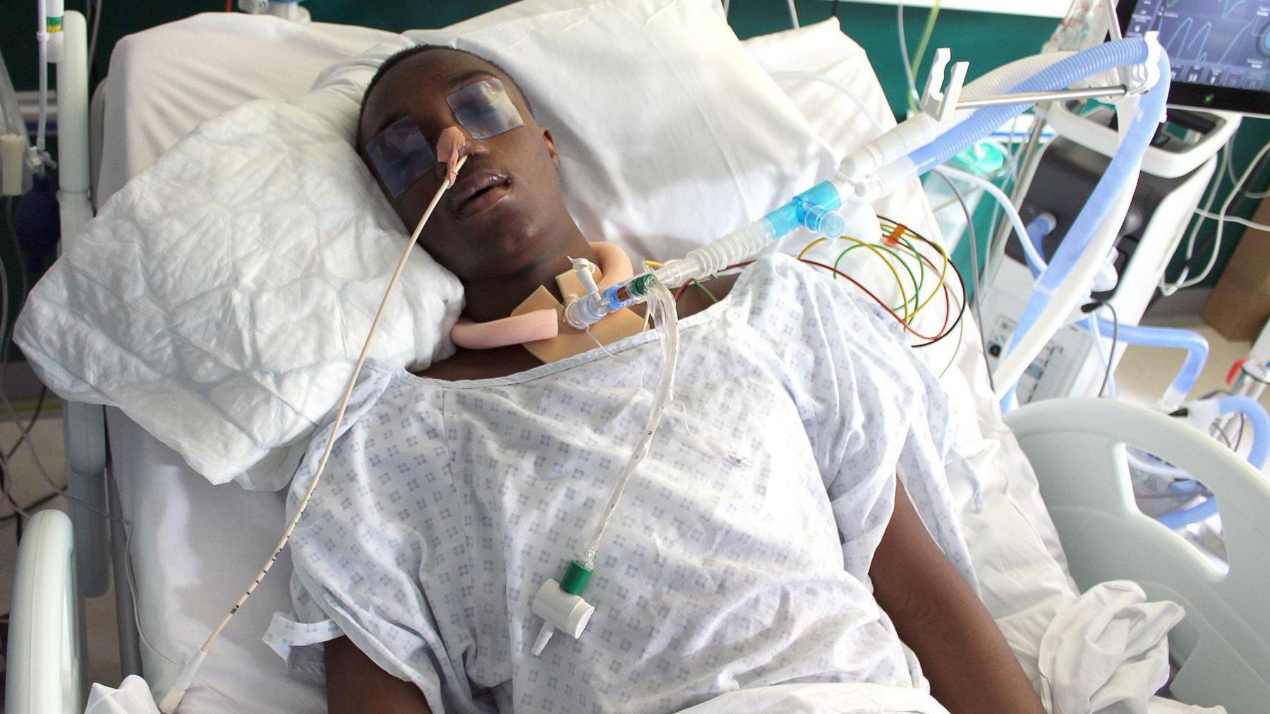 Jamel Boyce, a 17-year-old male, in a hospital bed. He is wearing a hospital gown and is attached to breathing apparatus. His eyes are taped closed.