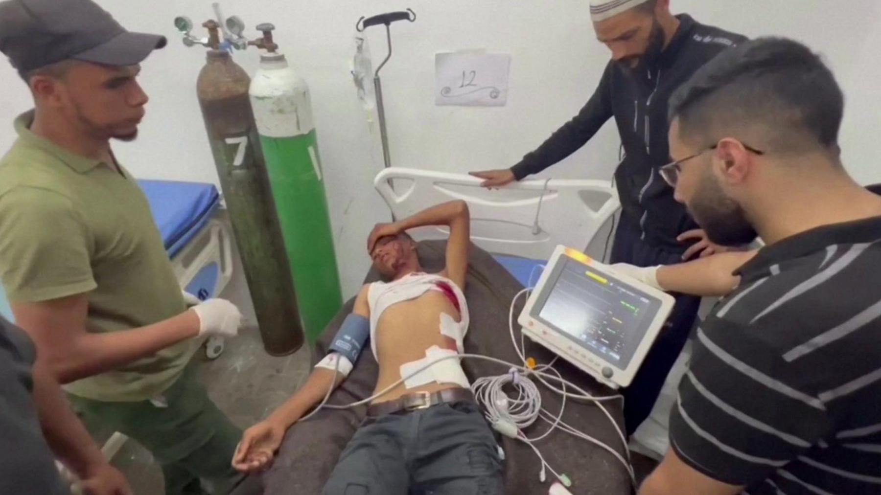 An injured man is treated at the Emirati hospital in Rafah, in the southern Gaza Strip (29 May 2024)