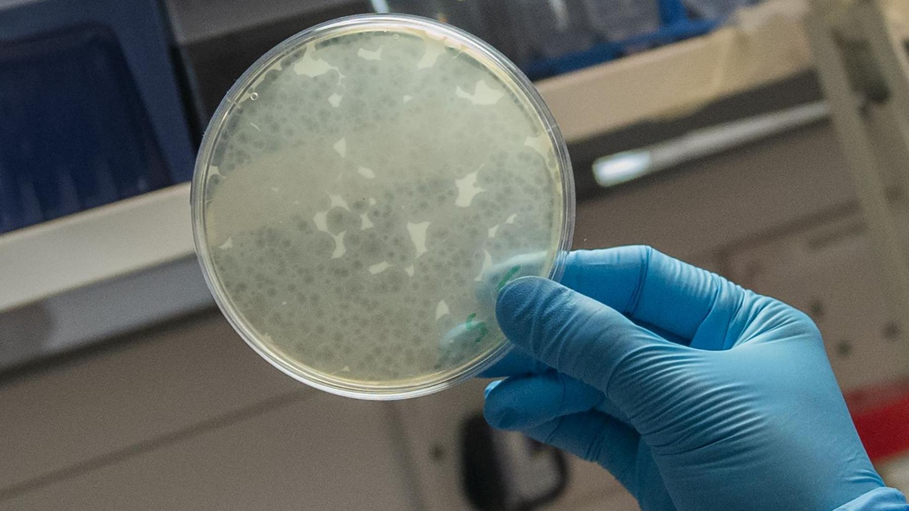 Close up of a petri dish held in a blue gloved hand