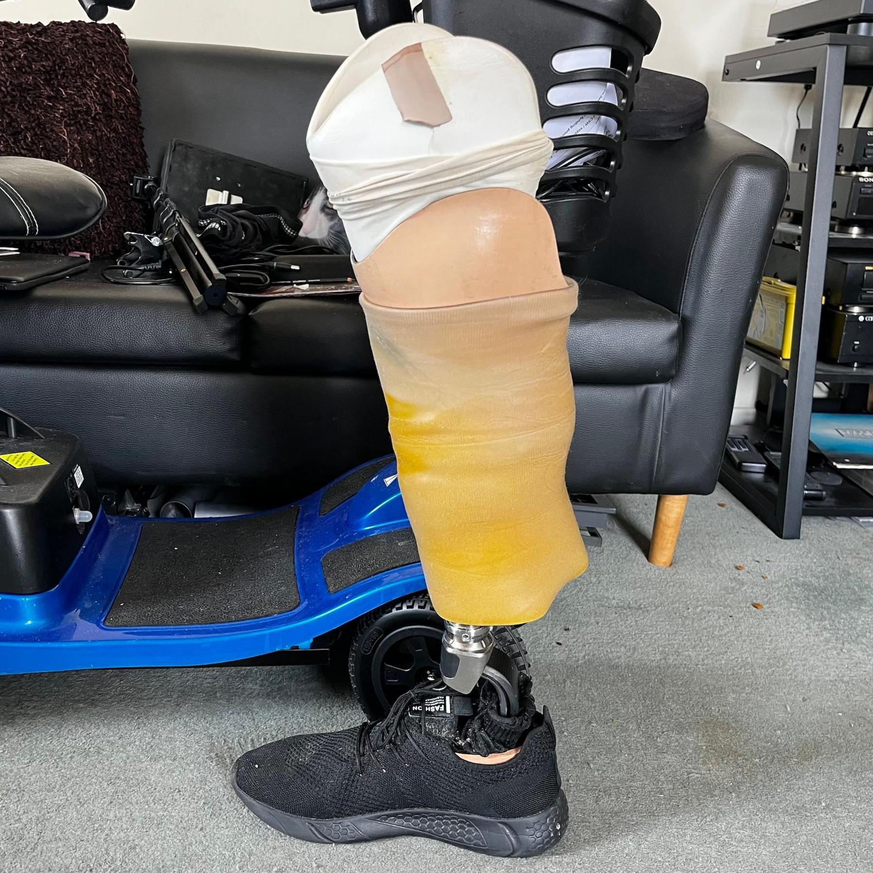 The image shows the man's prosthetic leg for his first amputation. The prosthetic leg has his shoe on and is pictured in his lounge. 