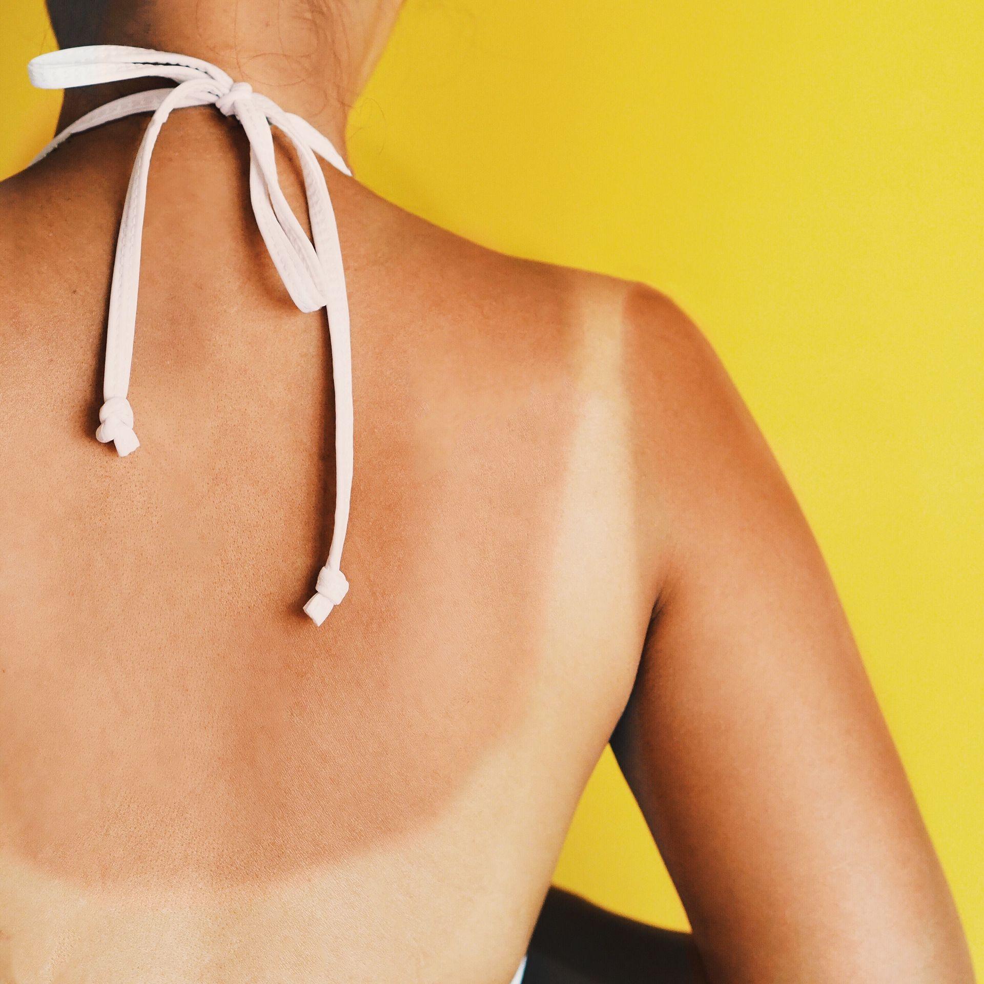 Tan lines on a woman's back. She has white straps around her neck and is standing in front of a yellow background.