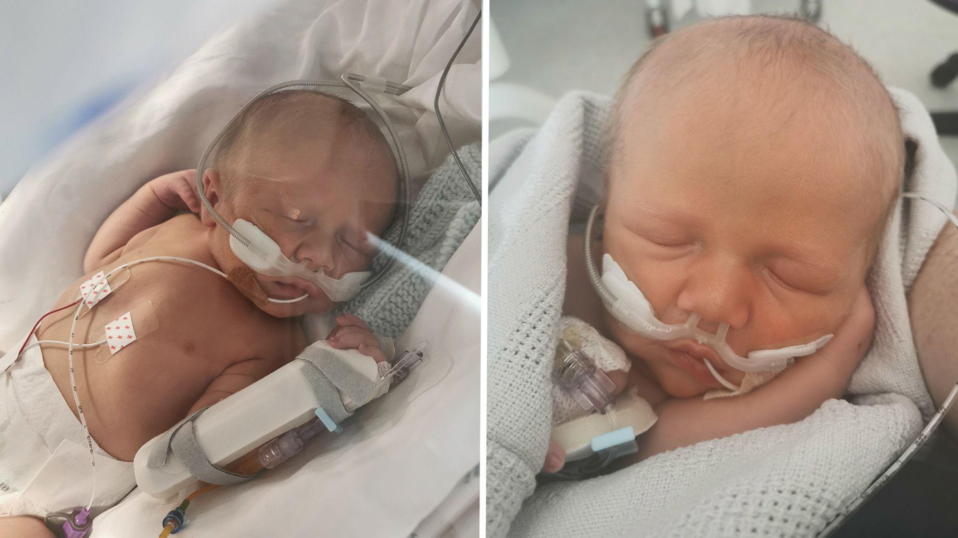 Hopcyn yn yr uned gofal dwys i'r newydd-anedig