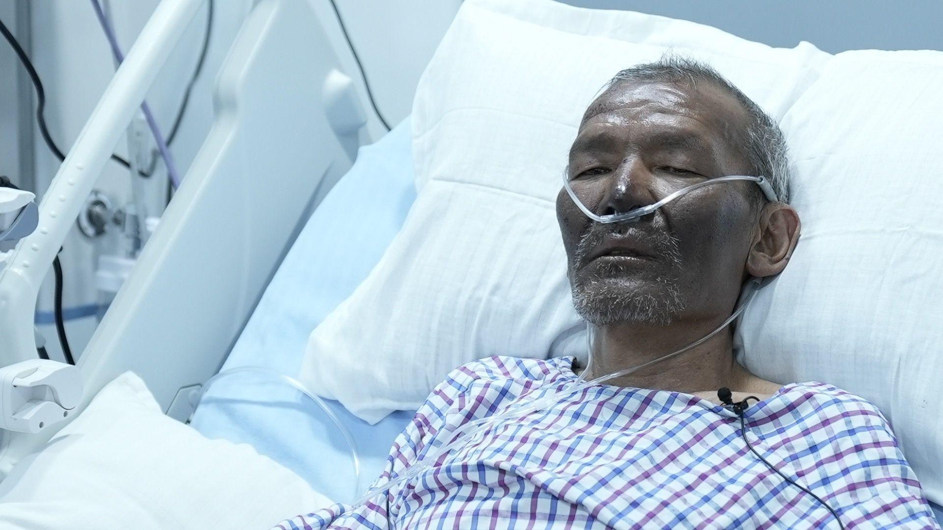 Hillary Dawa Sherpa in a hospital bed with a breathing tube
