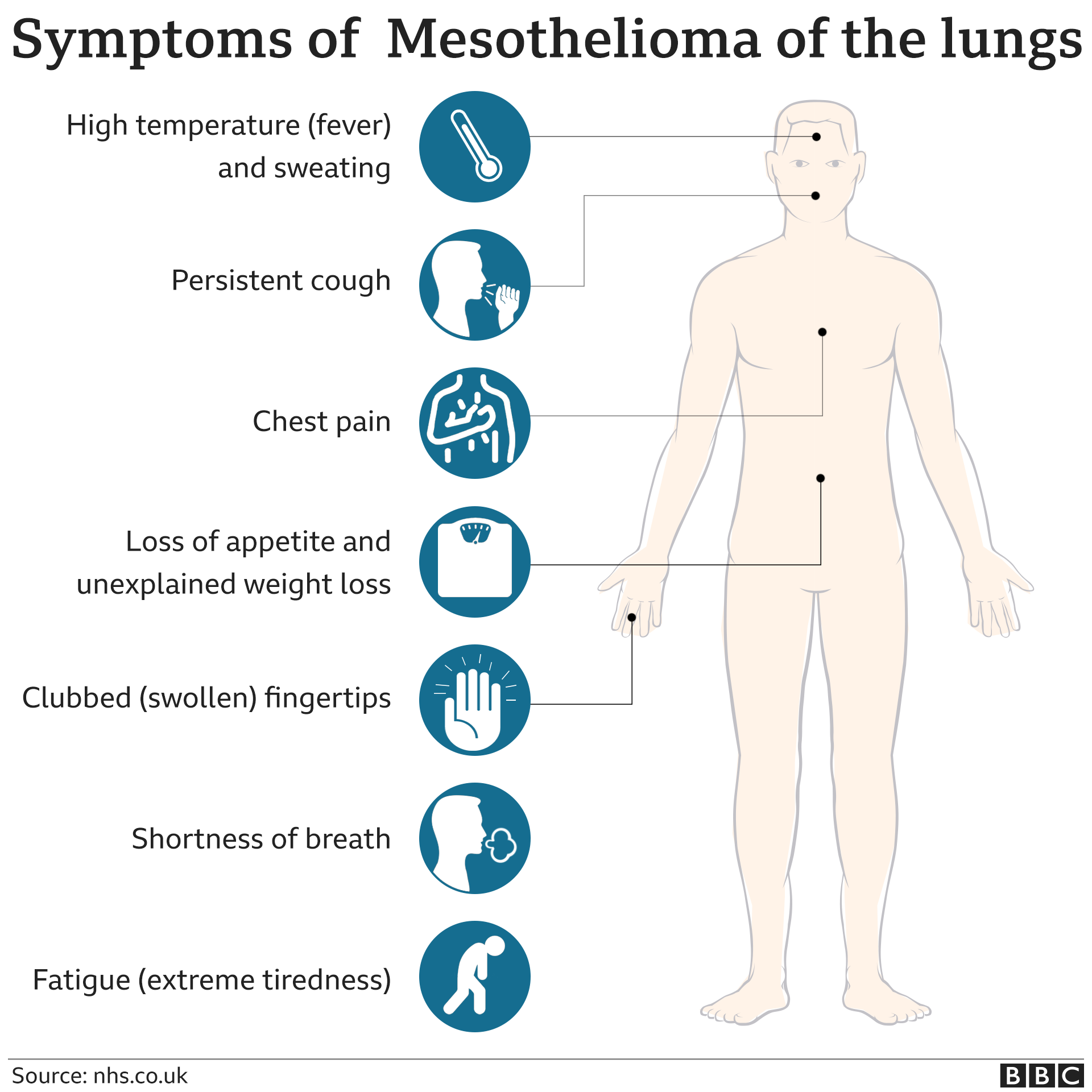 Symptoms of mesothelioma