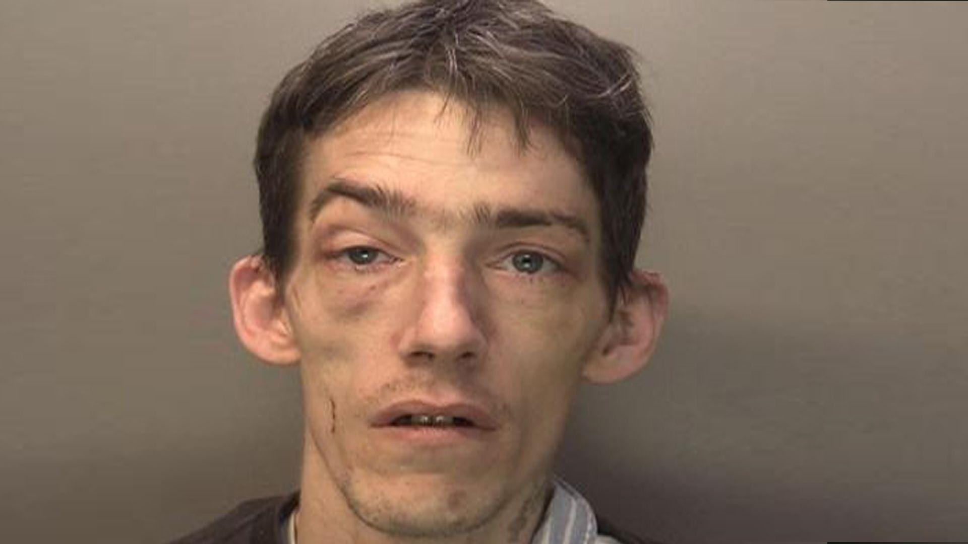 A police mugshot of a man with ruffled dark hair and marks on his face. 