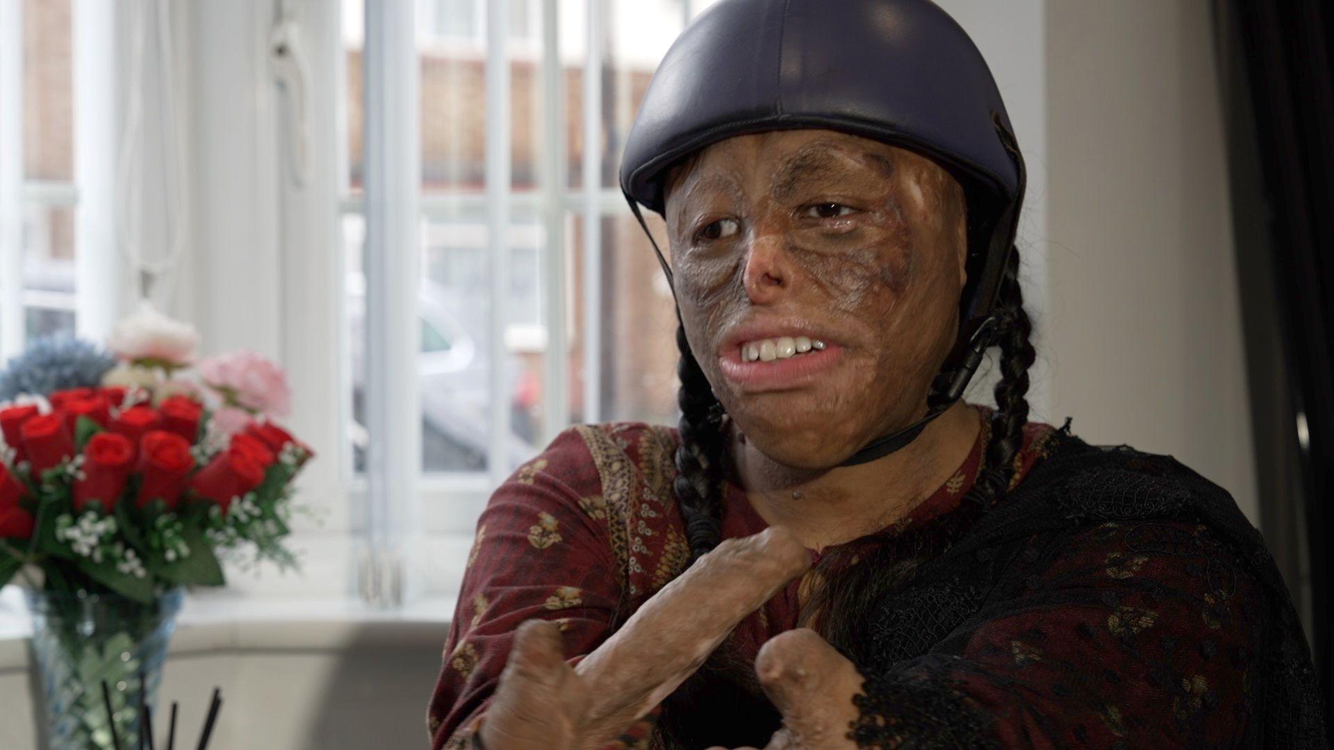 Shamiam Arif inside a house, wearing her helmet and raising her two arms to show her rebuilt forearms