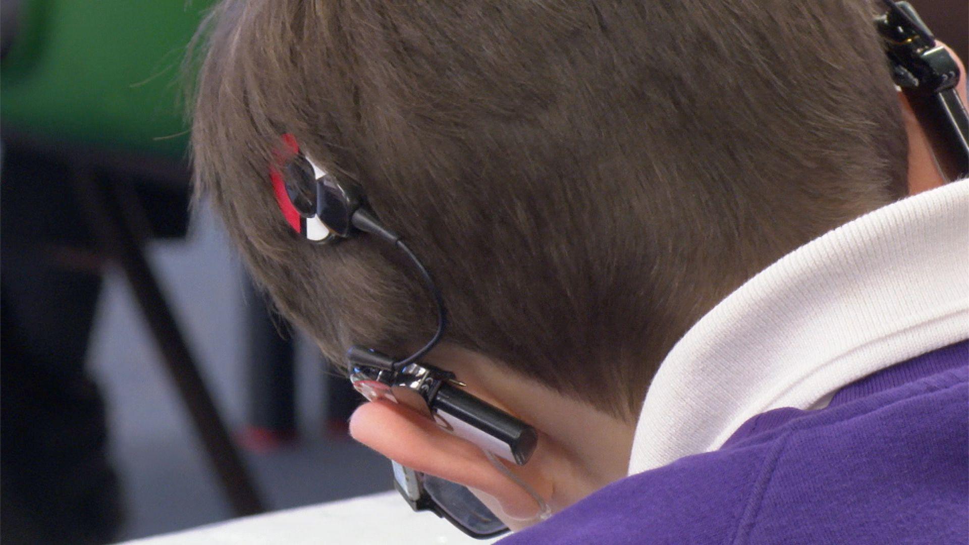 The back of a hearing impaired child's heard.