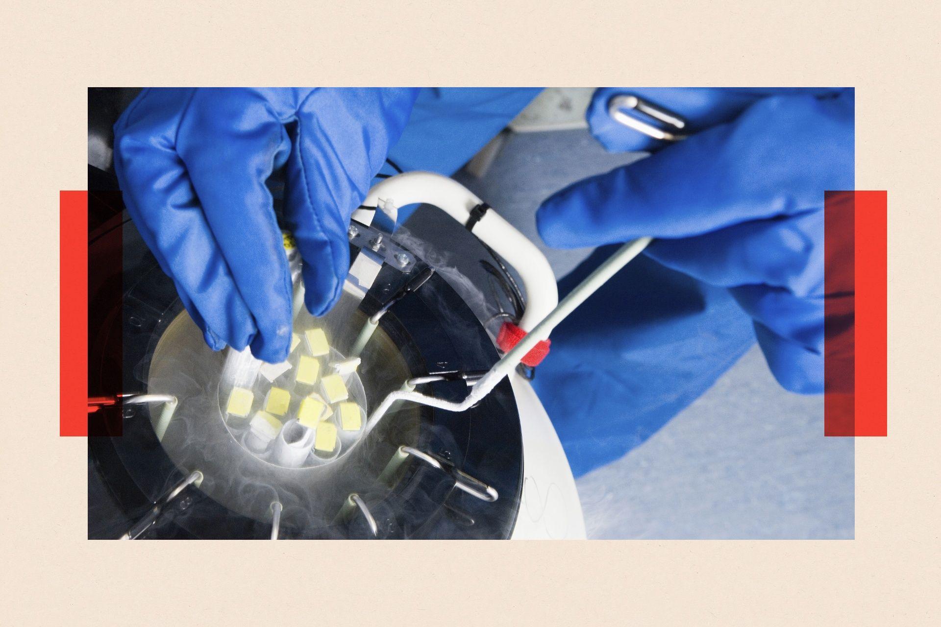 Doctors hands removing embryo samples from cryogenic storage