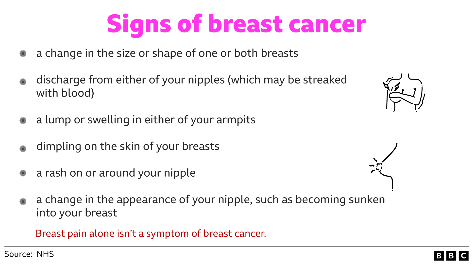 A graphic outlining the signs of breast cancer which are a change in the shape or size of one of both breasts, discharge from either nipple, a lump or swelling in either armpit, dimpling of the skin, a rash on or around the nipple and a change in the appearance of a nipple.