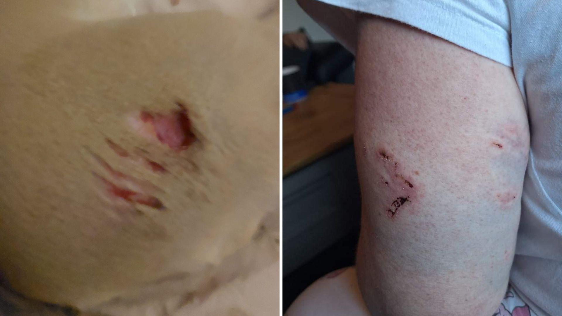 A split image showing injuries on the hide of a dog and the arm of a woman