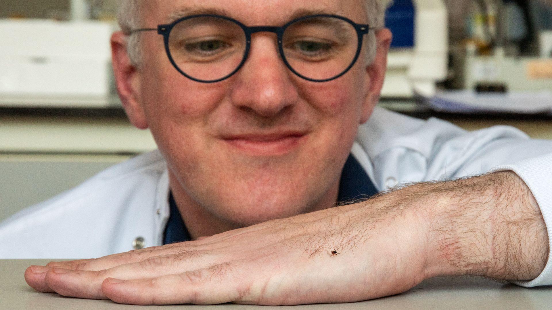 James Gallagher with tick on his hand