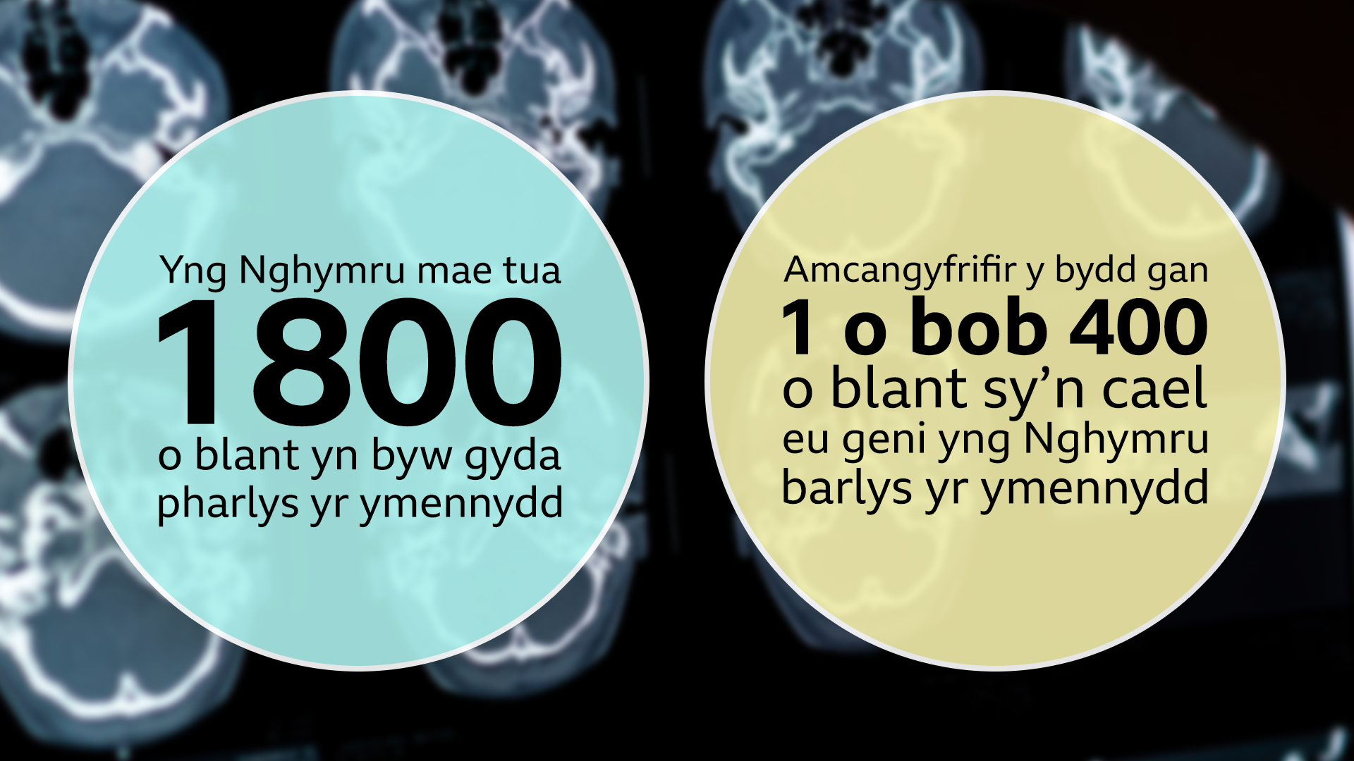 Graffeg beth yw parlys yr ymennydd