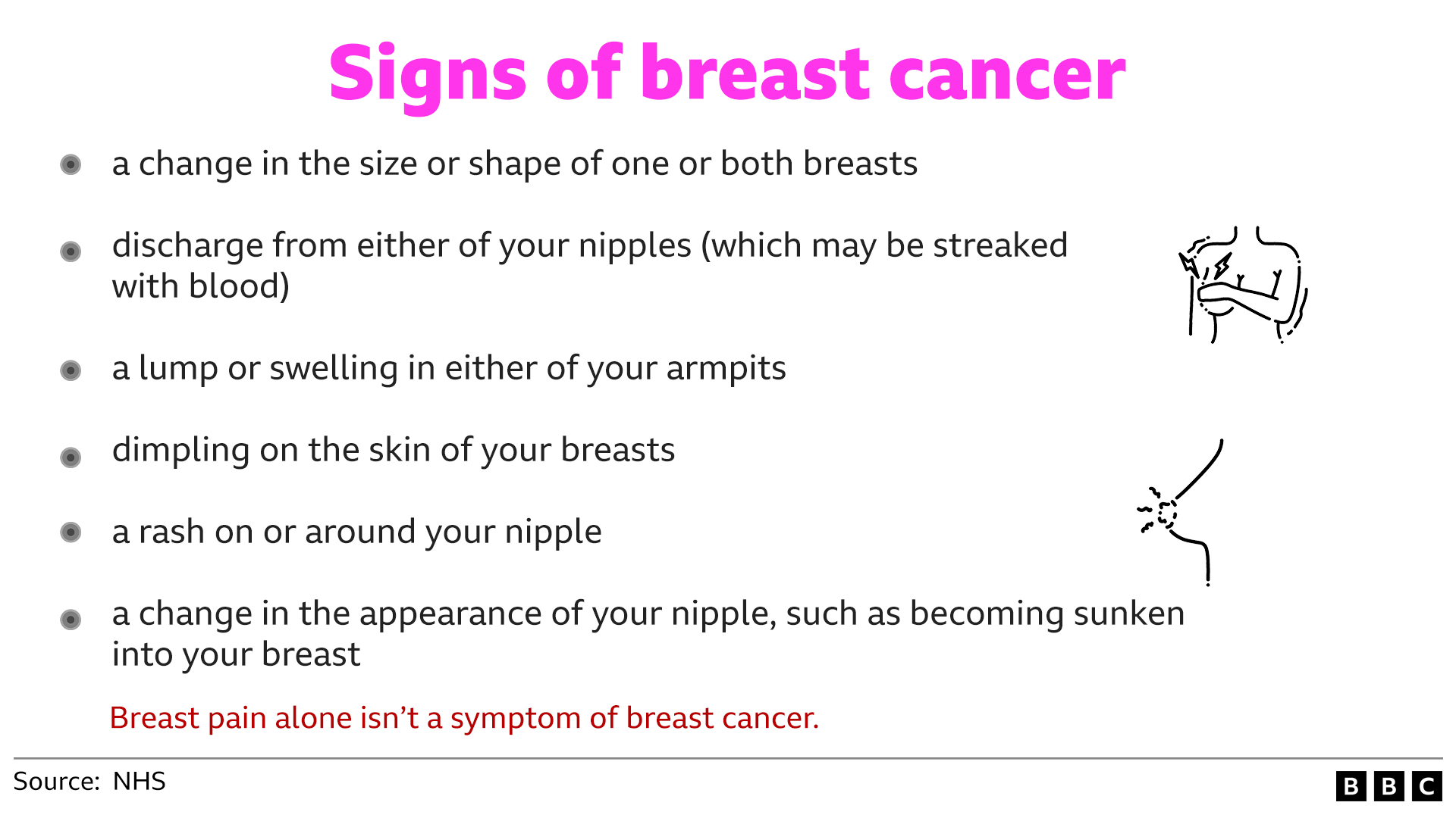 A graphic with headline in a pink font: Signs of breast cancer.
It also lists the following bullet points: A change in the size or shape of one or both breasts. Discharge from either of your nipples (which may be streaked with blood). A lump or swelling in either of your armpits. Dimpling on the skin of your breasts. A rash on or around your nipple. A change in the appearance of your nipple, such as becoming sunken into your breast. There is red writing at the bottom which says: Breast pain alone isn't a symptom of breast cancer. Two diagrams show a person examining their breast, with warning signs indicating pain, and a diagram of what appears to be a sore nipple. The BBC and NHS are credited.