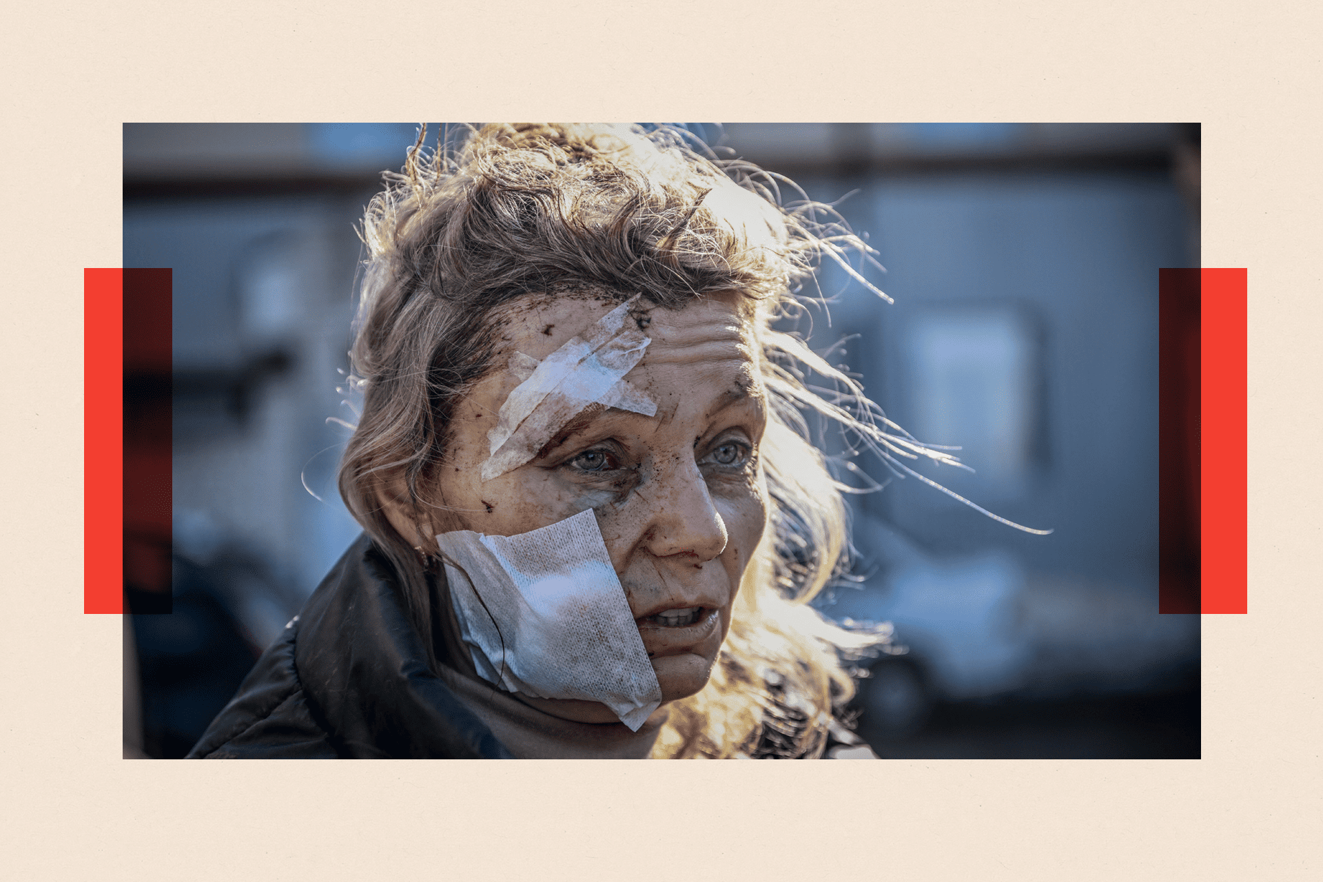 A woman stands outside with her face injured and bandaged after a bombing