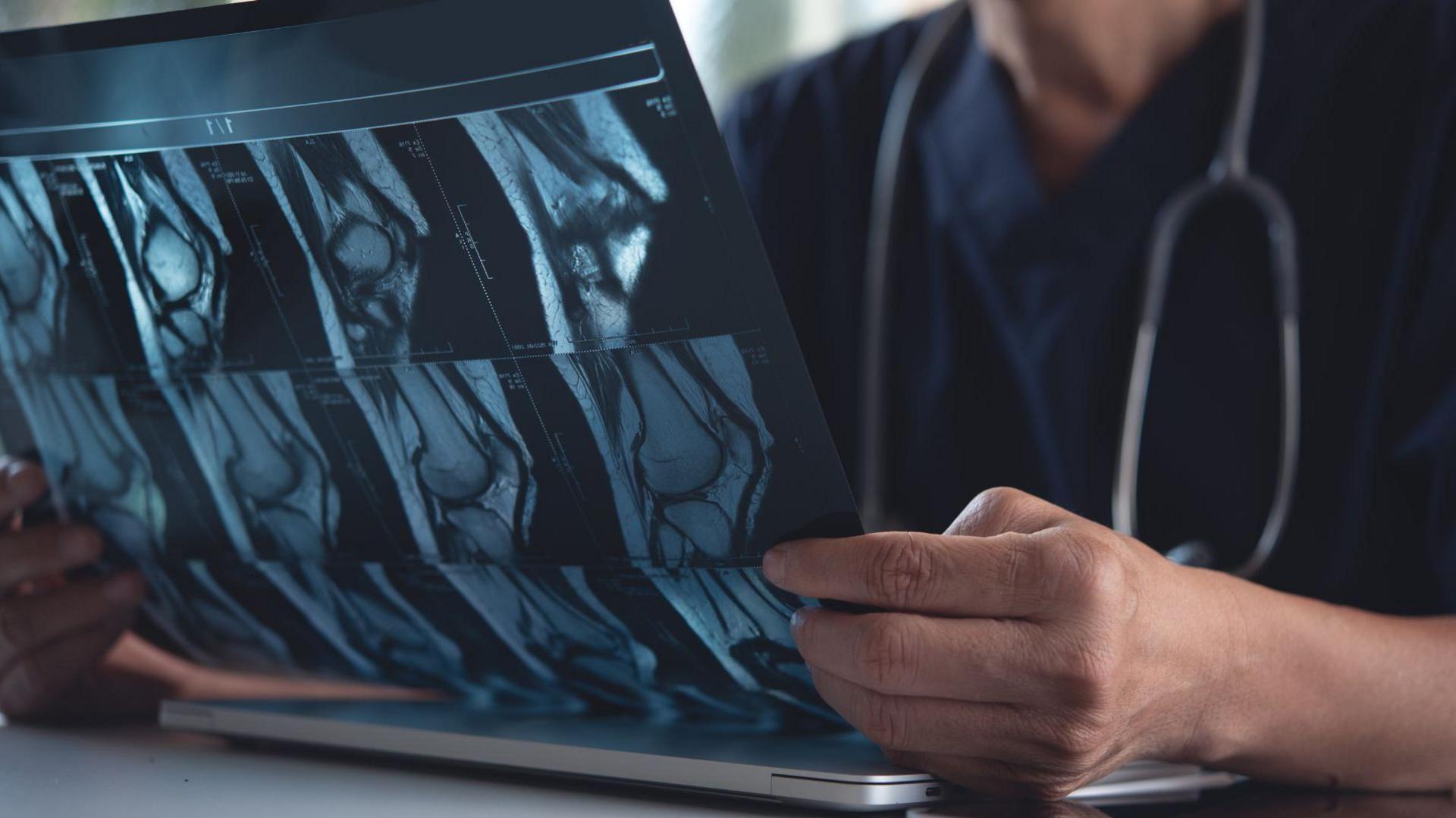 A man's hands holding an X-ray. The man is wearing a blue doctor's top.