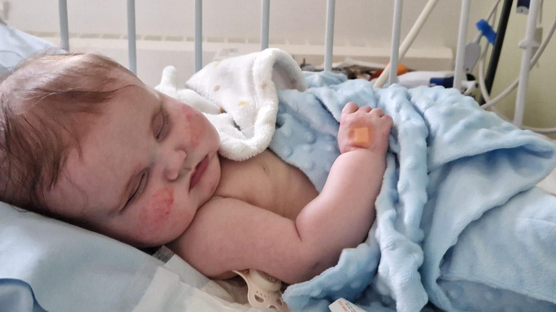 A baby of about a year old with reddish-blonde hair and ruddy red cheeks is asleep in a hospital cot, he is covered by a light blue fluffy blanket and has a round plaster on his left hand which is resting on top of the covers.