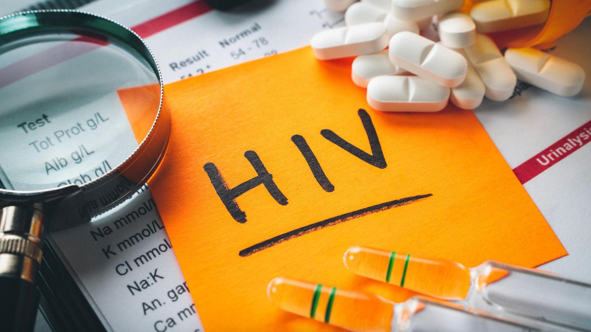 Orange paper with the word 'HIV' on it, alongside pills, a microscope and vials of liquid