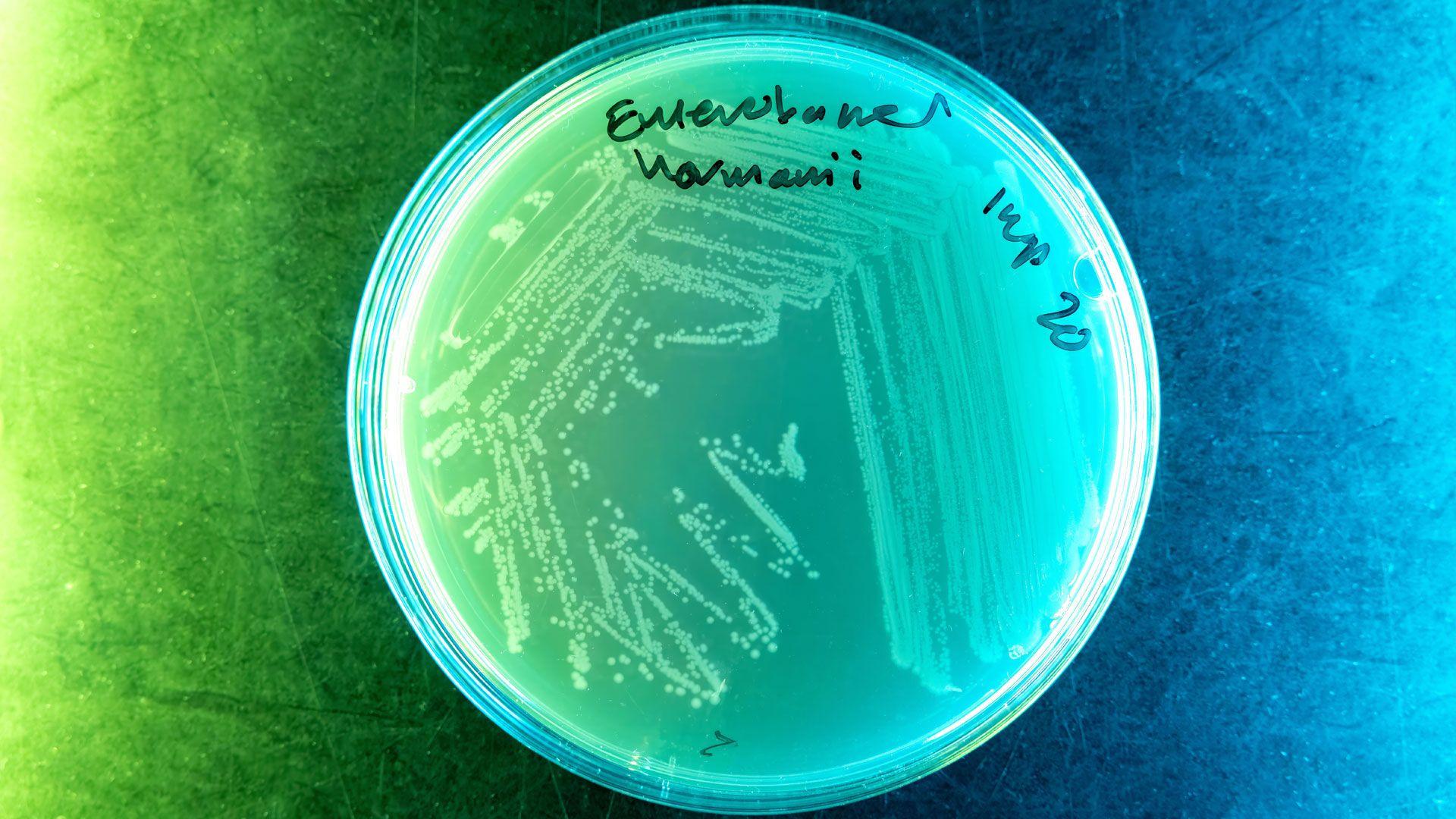 A round petri dish with handwritten labels on the lid. Inside, you can see dots in long squiggly lines - these represent bacterial growth. The whole thing is artistically lit - green on the left hand side, blue on the right and a blend in the middle. 