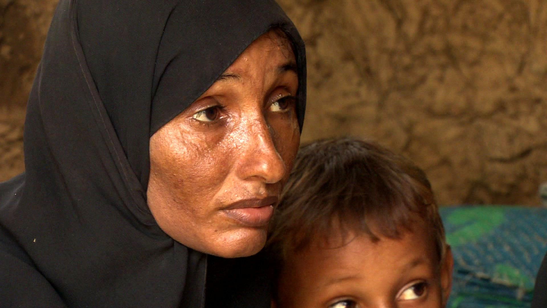 A Yemeni woman displaced by the crisis