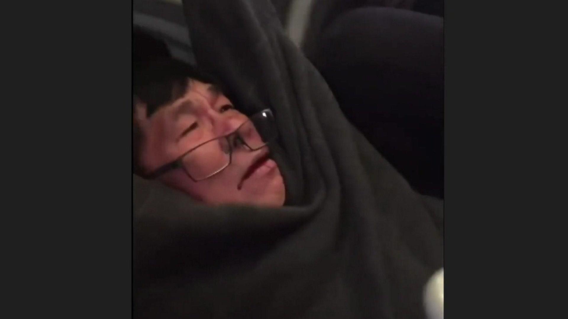 Passenger seen with glasses falling off and blood on his mouth