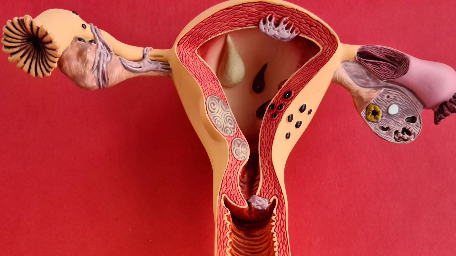 A uterus anatomy model against red background.