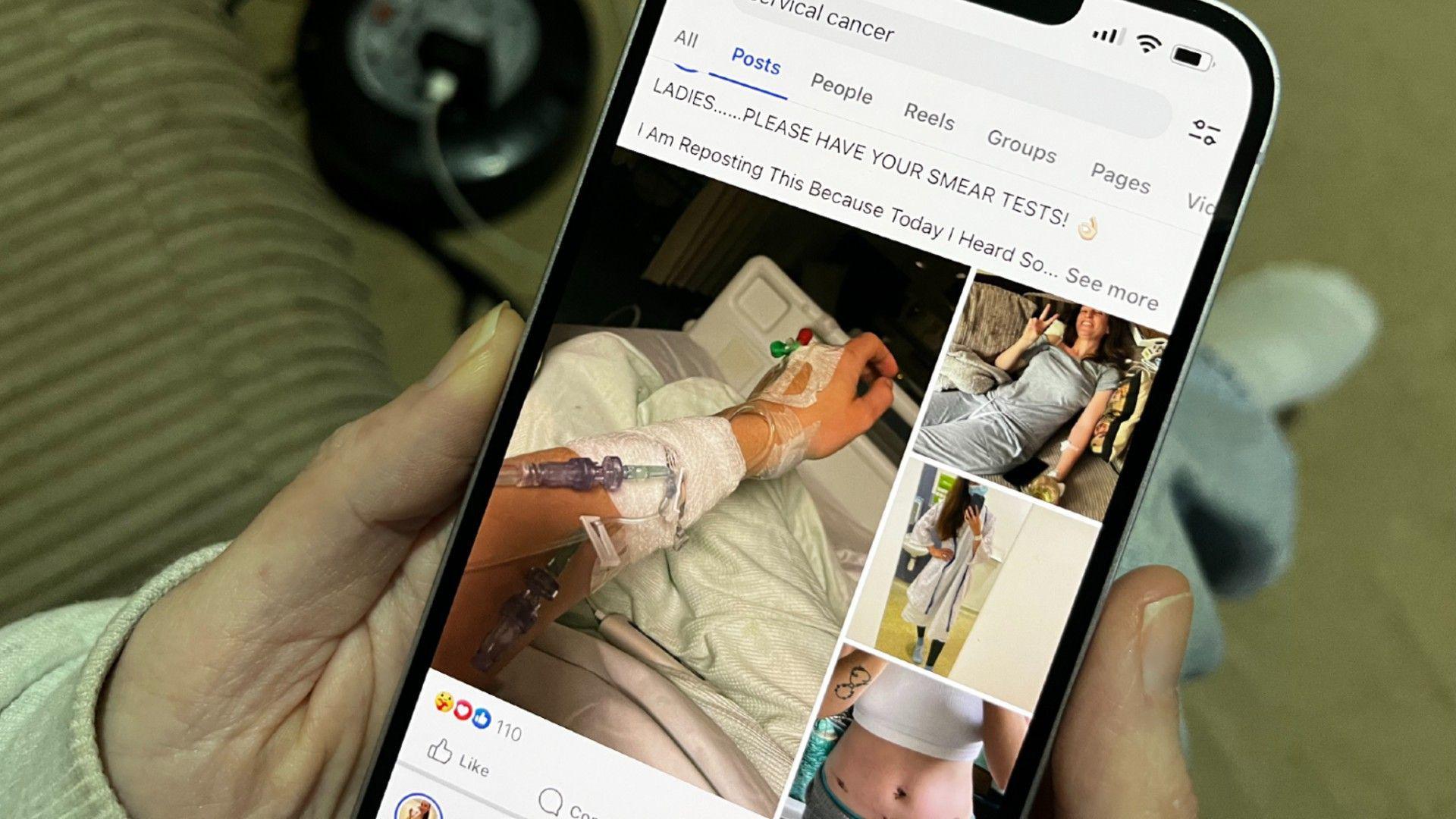 A close up of Stacey's phone which she is holding in her hands. On the phone is a composite image of her arm with a cannula fitted and three other photos of her in recovery and her surgery scars. Above the photo is a message that reads: "LADIES... PLEASE HAVE YOUR SMEAR TESTS!"