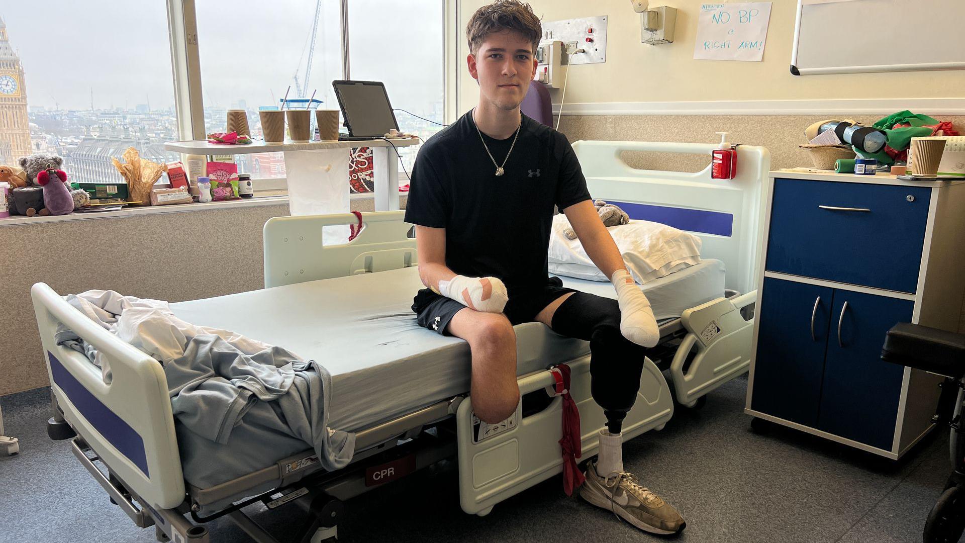 Hamish sits on a hospital bed and looks at the camera. He is wearing a prosthetic limb on his lower left leg, while his right is bare and amputated below the knee. Both his arms are bandaged from the wrist, and he is wearing a black t-shirt and black shorts.